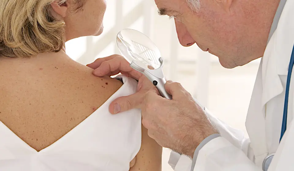 skin-cancer-check.png
